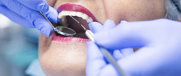 Best Emergency Dental Care for Broken or Chipped Teeth in Normal, IL
